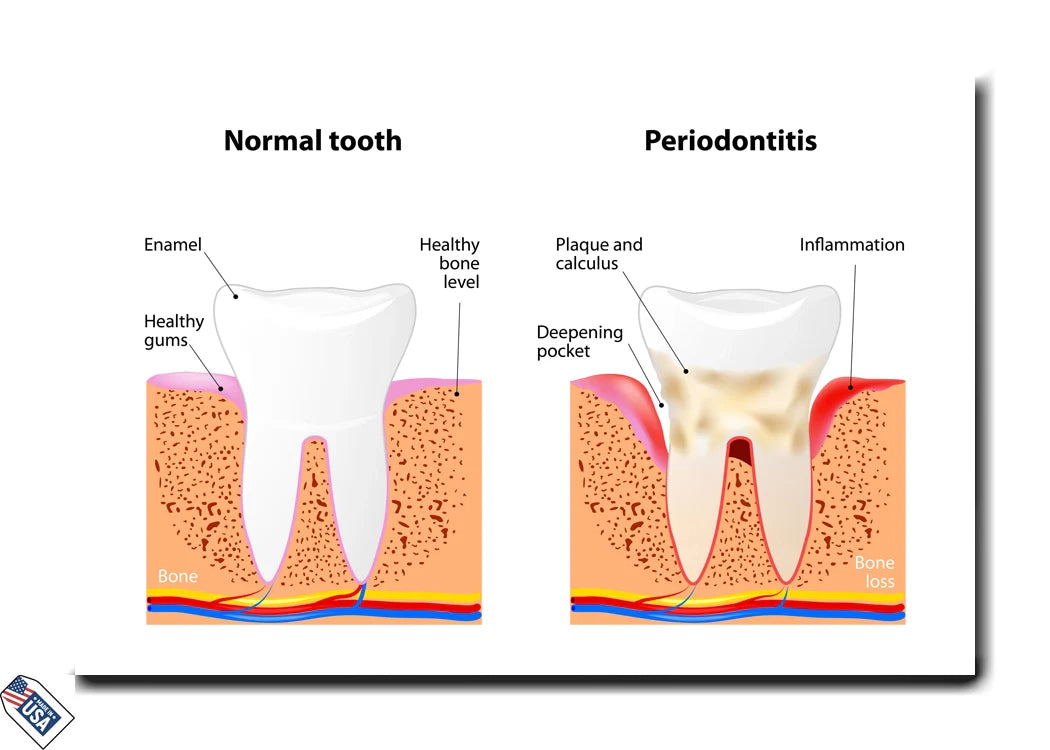 Oral Health Comparison - Educational Wall Art
