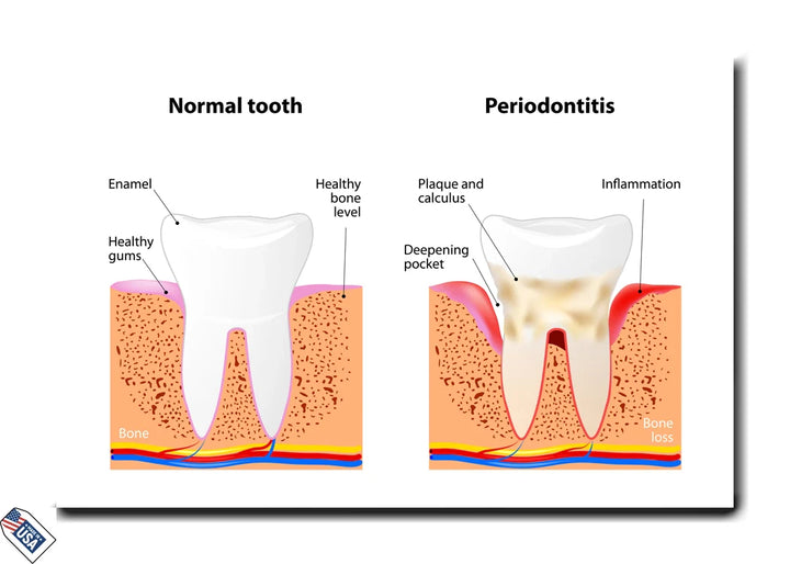 Oral Health Comparison - Educational Wall Art