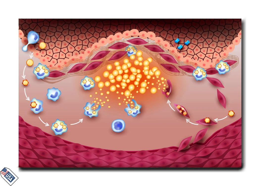 Atherosclerosis - Cellular Interaction in Plaque Formation